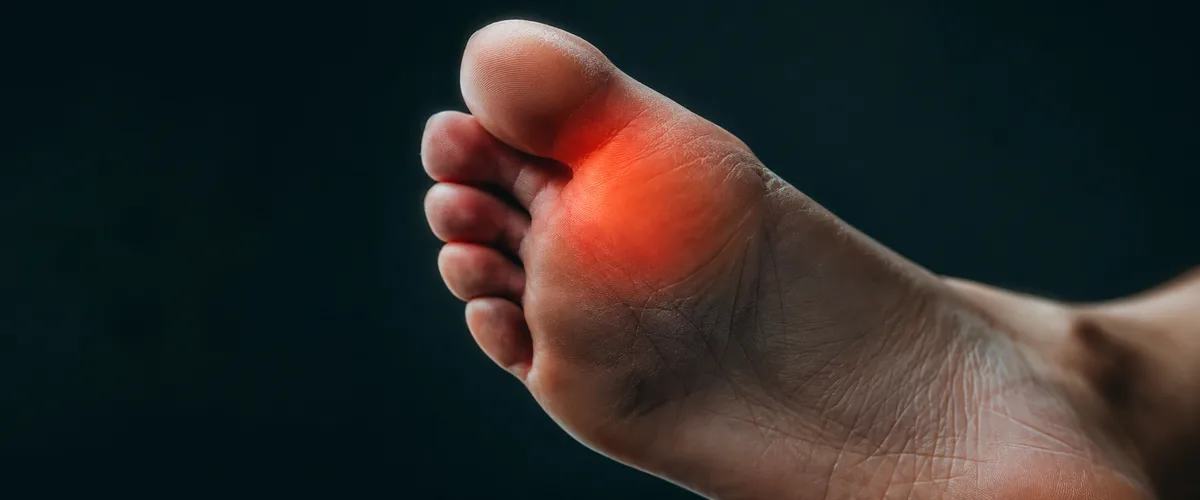 Sesamoiditis: dolor bajo el dedo gordo